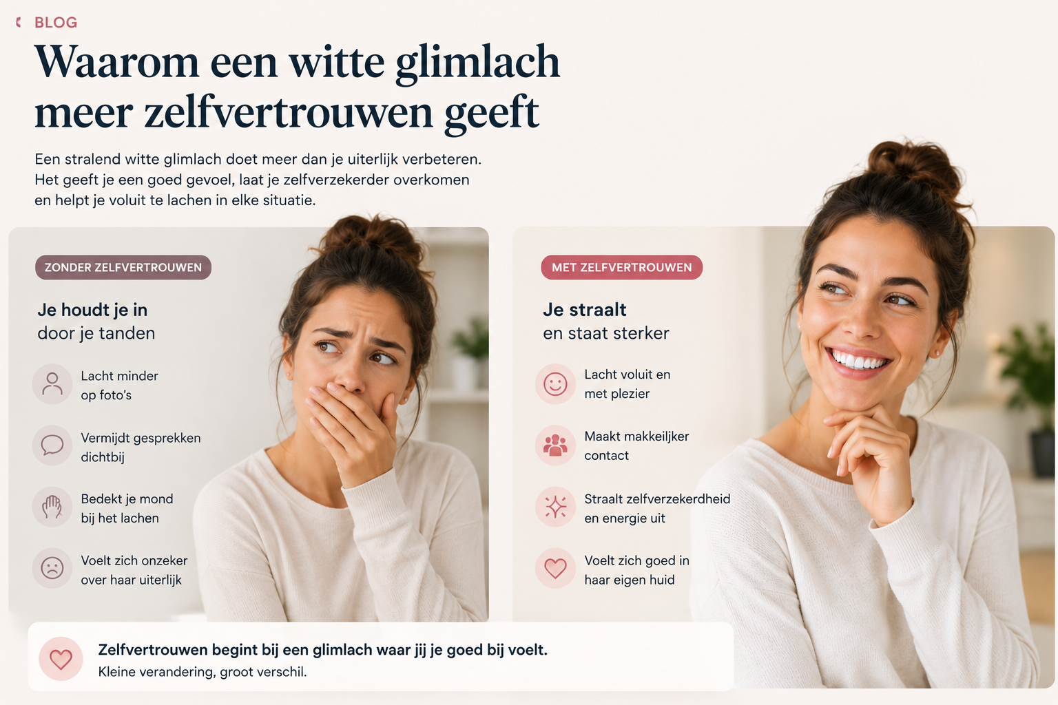 Waarom een witte glimlach meer zelfvertrouwen geeft